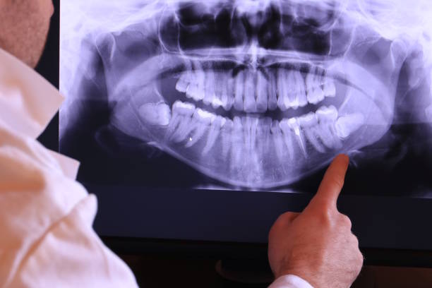 Best Weekend Emergency Dentist in Munsons Corners, NY