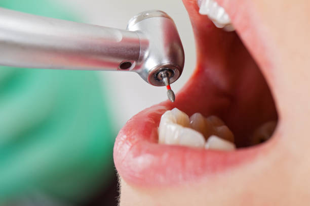 Best Emergency Treatment for Toothache in Munsons Corners, NY
